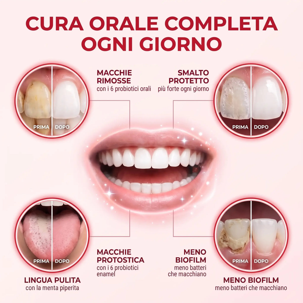 Dentifricio Sbiancante Probiotico Porexia™