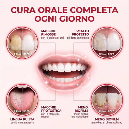 Dentifricio Sbiancante Probiotico Porexia™