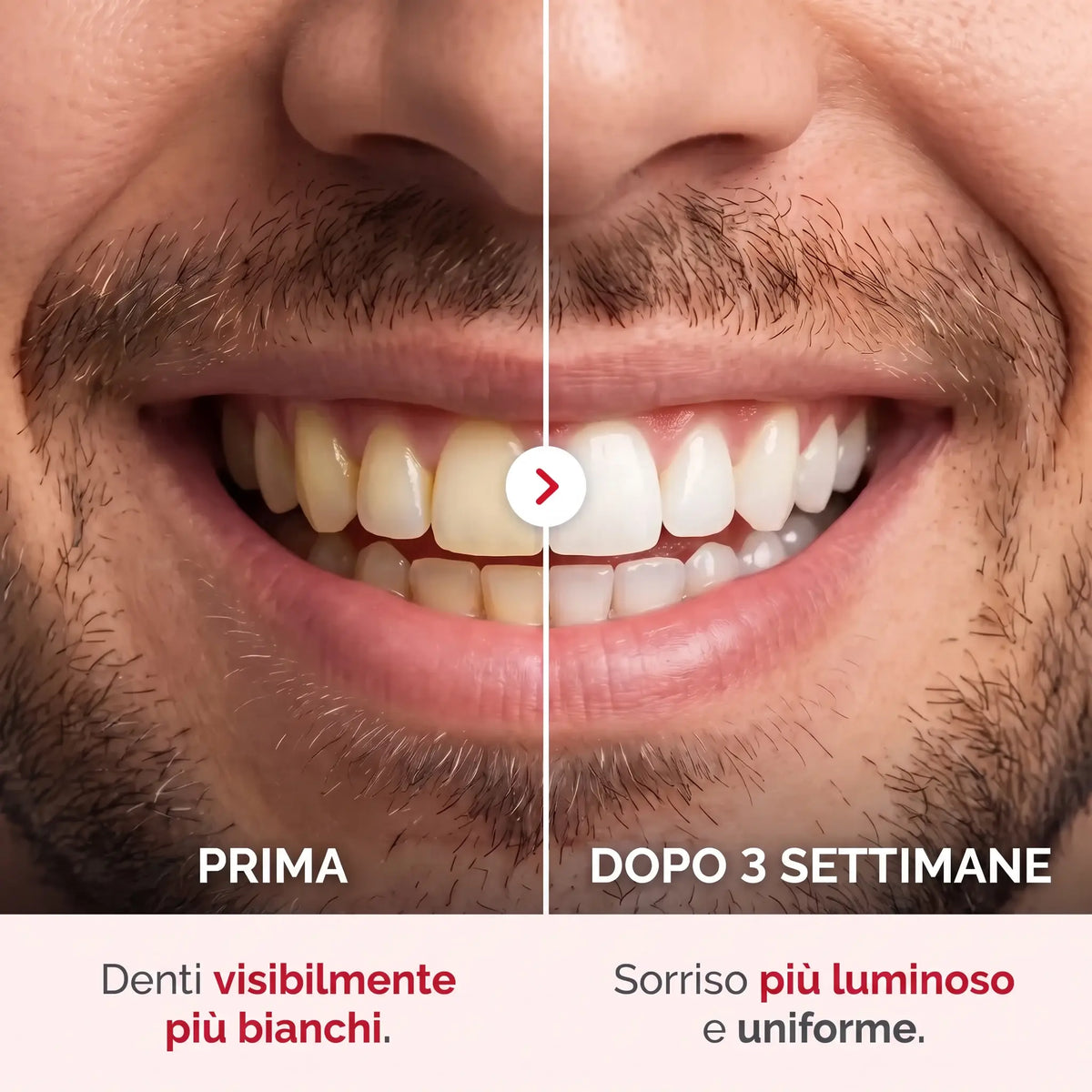 Dentifricio Sbiancante Probiotico Porexia™