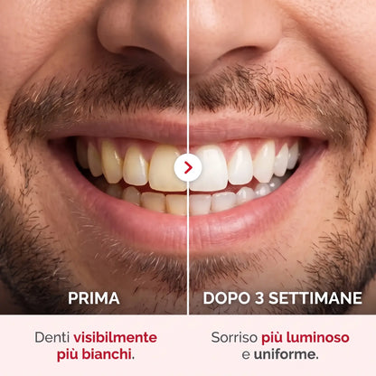 Dentifricio Sbiancante Probiotico Porexia™